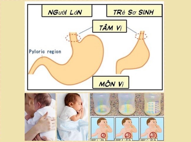 Cách giảm nôn trớ ở trẻ sơ sinh sau khi bú mẹ và bú bình (1)